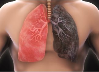 თუ ეწევით? მაშინ ეს  რჩევები თქვენთვისაა. გაიწმინდეთ ფილტვები სწრაფად და მარტივად