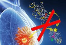 თუ გინდათ რომ კიბო არ დაგემართოთ, ეს 5 პროდუქტი უნდა ჭამოთ