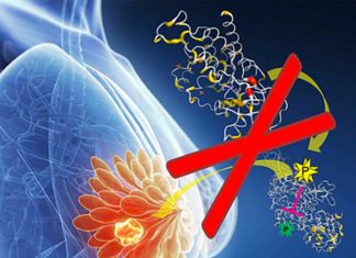 თუ გინდათ რომ კიბო არ დაგემართოთ, ეს 5 პროდუქტი უნდა ჭამოთ