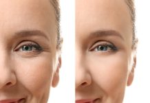 როგორ ვებრძლოთ ნაოჭებს სახეზე? – ამ  ნიღბის დახმარებით შედეგს 3 დღეში შეამჩნევთ