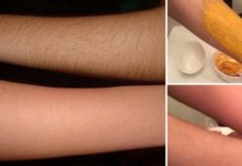 როგორ მოვიცილოთ სამუდამოდ არასასურველი თმა მარტივად