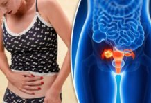 საკვერცხის კიბოს 6 სიმპტომი, რომლიც დაგეხმარებათ თავიდან აირიდოთ დაავადების განვითარება ან სიმსივნის რისკი