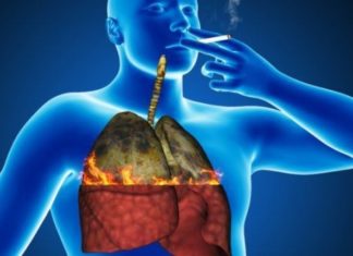 თუ მწეველი ხართ, ეს 4 პროდუქტი დაგეხმარებათ თქვენი ფილტვების გაწმენდაში