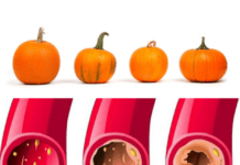 ნახეთ, როგორ მიირთვათ ნედლი გოგრა,რომ მან გაასუფთაოს თქვენი არტერიები და შეამციროს ქოლესტერინის დონეს