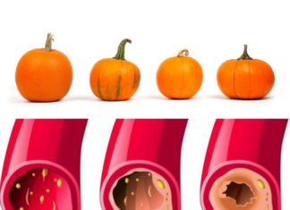 ნახეთ, როგორ მიირთვათ ნედლი გოგრა,რომ მან გაასუფთაოს თქვენი არტერიები და შეამციროს ქოლესტერინის დონეს