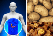 ხალხური რეცეპტები, რომელიც მოგიწესრიგებთ ღვიძლისა და ნაღვლის ბუშტის პრობლემებს