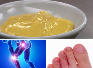 შეურიეთ ეს ინგრედიენტები ერთმანეთს და ის მოგაშორებთ სოკოს და განკურნავს თქვენს მტკივნეულ სახსრებს