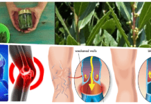 მოამზადეთ დაფნის ფოთოლის ზეთი, რომელიც სამუდამოდ დაგავიწყებთ ვენების ვარიკოზსა და სახსრების ტკივილს