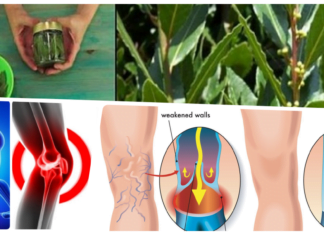 მოამზადეთ დაფნის ფოთოლის ზეთი, რომელიც სამუდამოდ დაგავიწყებთ ვენების ვარიკოზსა და სახსრების ტკივილს