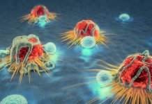 13 რჩევა, რომელიც დაგეხმარებათ კიბოს პრევენციაში