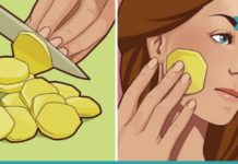 ის სახეზე უმ კარტოფილს ისვამდა, შედეგი სასწაულია… აუცილებლად უნდა ვცადო!