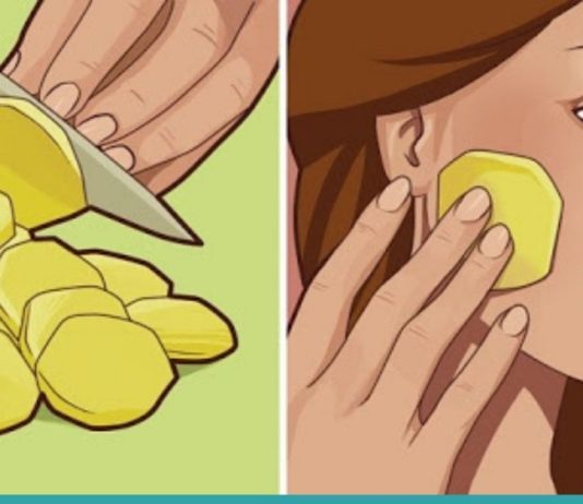 ის სახეზე უმ კარტოფილს ისვამდა, შედეგი სასწაულია… აუცილებლად უნდა ვცადო!