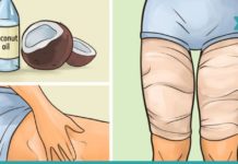 მან ფეხები შეიხვია და მთელი ღამით გაჩერდა, მეორე დღეს დიდი ცვლილება მოხდა!