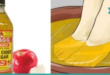 აი რისთვის იყენებს ის ვაშლის ძმარს. ასეთ შედეგს ნამდვილად არ ველოდი!