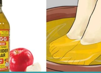 აი რისთვის იყენებს ის ვაშლის ძმარს. ასეთ შედეგს ნამდვილად არ ველოდი!