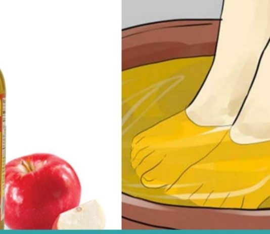 აი რისთვის იყენებს ის ვაშლის ძმარს. ასეთ შედეგს ნამდვილად არ ველოდი!