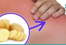 ამ ადამიანს მარილები დაუგროვდა კისერზე… წაიკითხეთ ეს სტატია და მოიშორეთ ტკივილები!