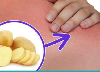 ამ ადამიანს მარილები დაუგროვდა კისერზე… წაიკითხეთ ეს სტატია და მოიშორეთ ტკივილები!