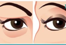 როგორ ვუშველოთ ჩამოწელილ ქუთუთოს! ნეტავ, აქამდე მცოდნოდა…