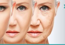 ბოტოქსი სახლის პირობებში – სამუდამოდ დაემშვიდობეთ ნაოჭებს