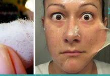 ამ ორმა პროდუქტმა შავი წერტილები სამუდამოდ გამიქრო – ნახეთ როგორ დაამზადოთ სასაწაულმოქმედი ნიღაბი