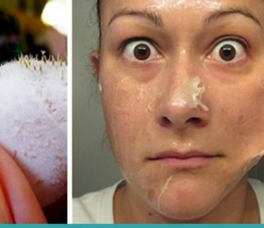 ამ ორმა პროდუქტმა შავი წერტილები სამუდამოდ გამიქრო – ნახეთ როგორ დაამზადოთ სასაწაულმოქმედი ნიღაბი