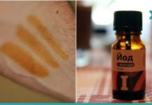 აი, რა მოხდება თუ იოდს მაჯებზე წაისვამთ-სასარგებლო ინფორმაციაა!