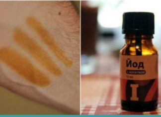აი, რა მოხდება თუ იოდს მაჯებზე წაისვამთ-სასარგებლო ინფორმაციაა!