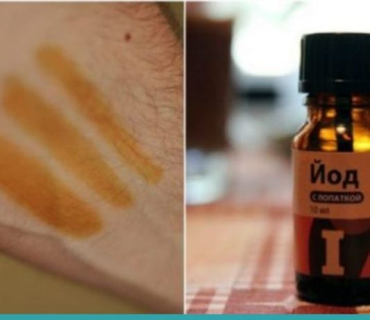 აი, რა მოხდება თუ იოდს მაჯებზე წაისვამთ-სასარგებლო ინფორმაციაა!