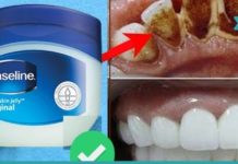 კბილების გათეთრება ვაზელინის დახმარებით. ეს მეთოდი ყველას მოეწონება