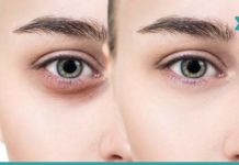 7 რჩევა, რომლებიც თვალების ირგვლივ სიშავესა და შეშუპებას მოგაცილებთ.. გაახალგაზრდავდით!