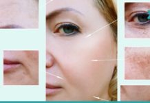 სუპერმეთოდი!! პიგმენტური ლაქების მოცილება სახლის პირობებში. შედეგი 100% – ია!