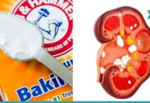 აი, რა მოუვა თქვენს თირკმელებს თუ ნახევარ კოვზ საკვებ სოდას მიიღებთ…