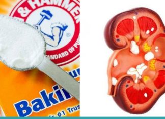 აი, რა მოუვა თქვენს თირკმელებს თუ ნახევარ კოვზ საკვებ სოდას მიიღებთ…