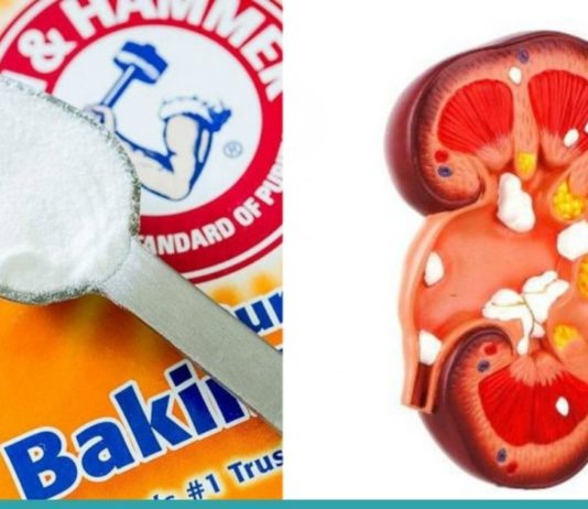 აი, რა მოუვა თქვენს თირკმელებს თუ ნახევარ კოვზ საკვებ სოდას მიიღებთ…