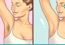 წყალბადის ზეჟანგი, რომელიც არასასურველი თმის მოშორებაში დაგეხმარებათ! იაფი და ეფექტურია