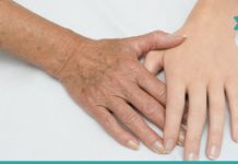 მარტივი და უიაფესი გზა შავი და ყავისფერი ლაქების მოსაშორებლად!