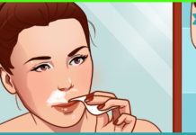 როგორ უნდა მოიშოროთ სახიდან არასასურველი თმა? ბევრჯერ ნაცადი და ეფექტური მეთოდი