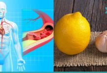 არტერიების გასუფთავება ნიორის და ლიმონის დახმარებით. ყველაზე ეფექტური საშუალება!