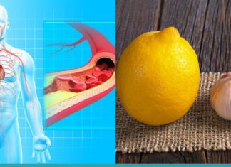 არტერიების გასუფთავება ნიორის და ლიმონის დახმარებით. ყველაზე ეფექტური საშუალება!