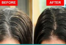 ეს ნატურალური საშუალება ჭაღარა თმას მოგაშორებთ! ქიმიური საღებავები აღარ დაგჭირდებათ!