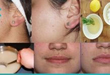 სახიდან ზედმეტი თმის მოშორების ბუნებრივი მეთოდები-გაიგეთ მეტი!