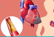 დაემშვიდობეთ მაღალ არტერიულ წნევას და ქოლესტერინს ამ სასმელის დახმარებით.