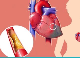 დაემშვიდობეთ მაღალ არტერიულ წნევას და ქოლესტერინს ამ სასმელის დახმარებით.