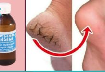 აი, როგორ უნდა გამოიყურებოდეს თქვენი ქუსლები ლამაზად-სუპერ ეფექტური მეთოდი!