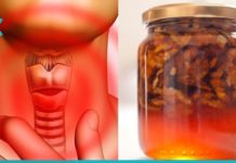 ექიმები ამას არასდროს გეტყვიან: აი როგორ განვკურნოთ ფარისებრი ჯირკვალი ერთი ინგრედიენტით!