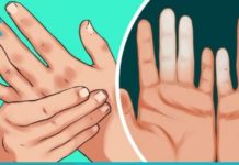 ხელები და ფეხები ხშირად გიცივდებათ? ის, რაც სისხლის მიმოქცევას დაგირეგულირებთ