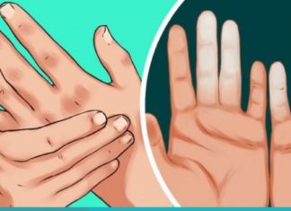 ხელები და ფეხები ხშირად გიცივდებათ? ის, რაც სისხლის მიმოქცევას დაგირეგულირებთ