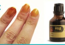 რატომ უნდა წავისვათ იოდი ფრჩხილებზე? მიიღეთ საოცარი შედეგი მარტივად!