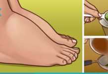 ეს ხალხური საშუალებები დაგავიწყებენ ფეხების შეშუპების პრობლემას. სცადეთ და თავად დარწმუნდებით